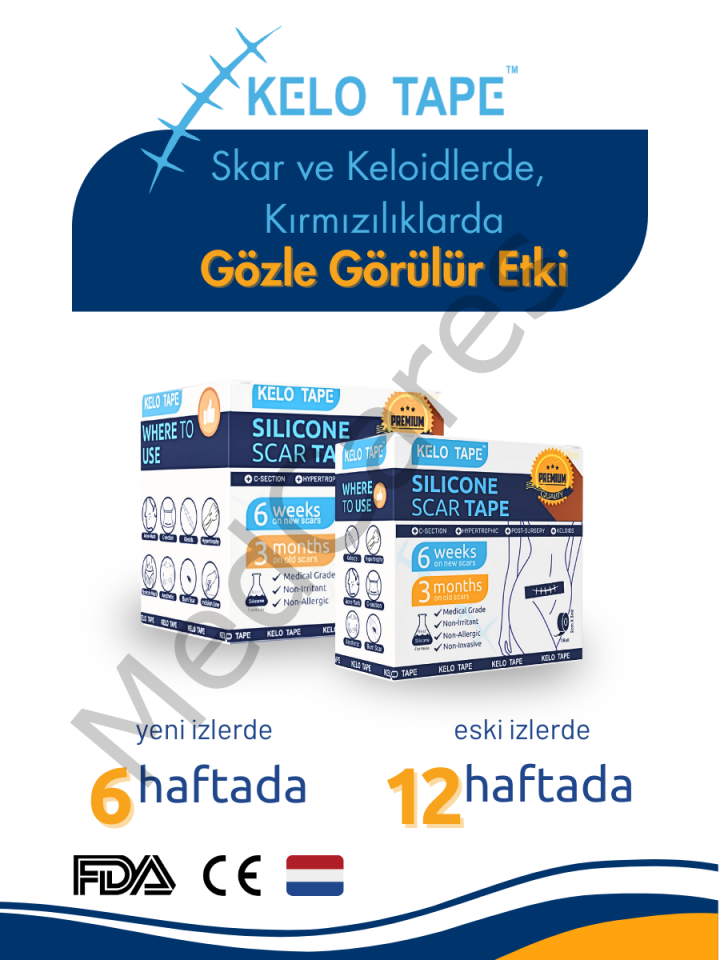 Kelo Tape Soft Silikon Bant Estetik Keloid Yanık Sezaryen Dikiş Ameliyat İzi Giderici 2,5 cm x 3 mt