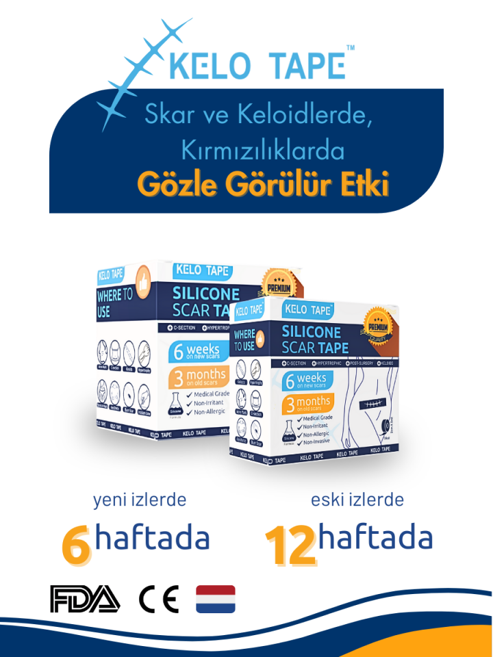 KELO TAPE Soft Silikon Bant Estetik Keloid Yanık Sezaryen Dikiş Ameliyat İzi Giderici 2,5 cm x 3 mt
