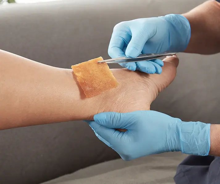 Algivon Plus %100 Manuka Balı İçerikli Aljinat Yara Örtüsü (10cm x 10cm)