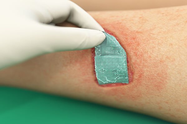 Sorbact Gel Compress Jelli Yara Örtüsü 7.5x7.5 cm
