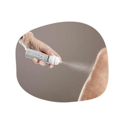 Opsıte Yara Kapatıcı Suya Dayanıklı Sprey - 100ml