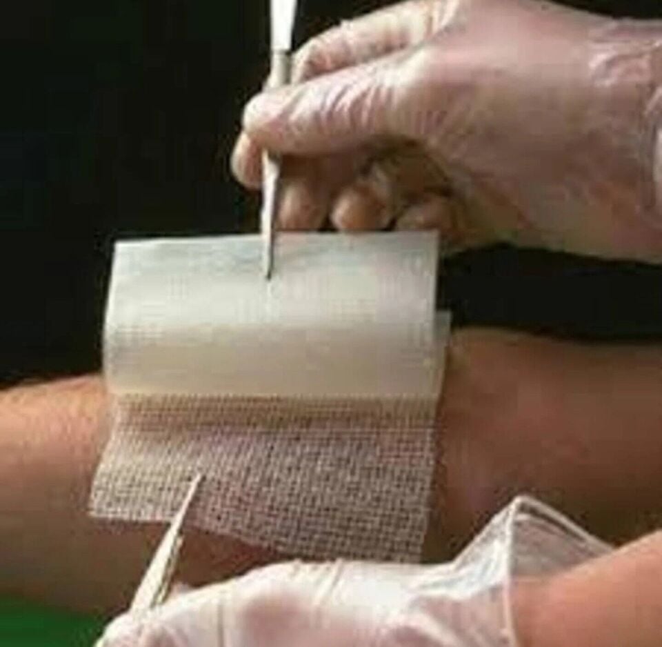 BACTIGRAS Parafinli, Antiseptik Tül Sargı Bezi, Yara ve Yanık Örtüsü, Steril  5cm x 5cm