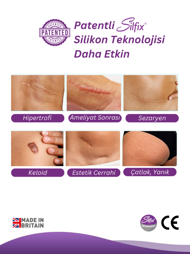 SİLTAPE Soft Silikon Bant Estetik Keloid Yanık Sezaryen Dikiş Ameliyat Izi Giderici 2cm X 3mt