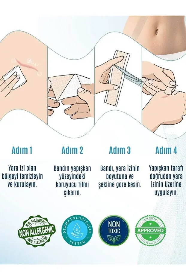 KELO TAPE Soft Silikon Bant Estetik Keloid Yanık Sezaryen Dikiş Ameliyat İzi Giderici 2 cm x 1 mt