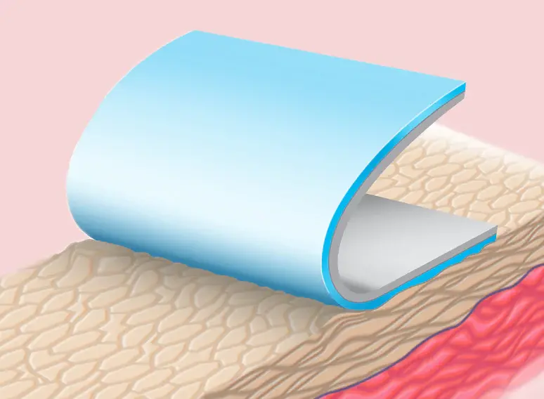 Advasil Conform Medikal Silikon Jel Tabaka (10cm x 15cm) –İz Giderici-Scar Tedavisi- Profesyonel Yara İzi Yönetimi